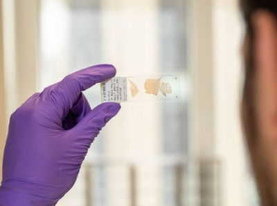 Científicos de Stanford logran revertir síntomas similares al autismo en ratones usando fármacos contra la epilepsia