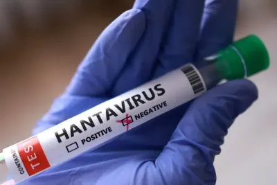 Hantavirus: cómo se contagia, cuál es su letalidad y cómo se transmite entre personas