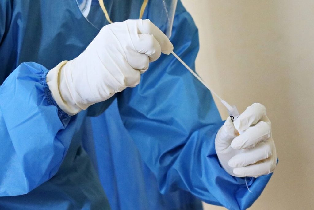 Virus Shamonda: la OMS considera «poco probable» su propagación en humanos